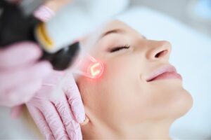 Pico Laser Facial
