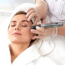 Microneedling Facial